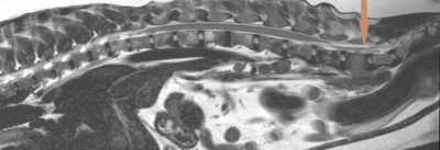 MRI Prostate Mass 1