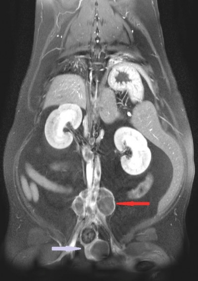 MRI Prostate Mass 7