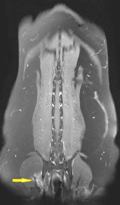 MRI Prostate Mass 9