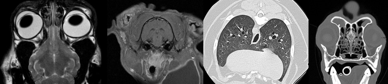 mri vs ct